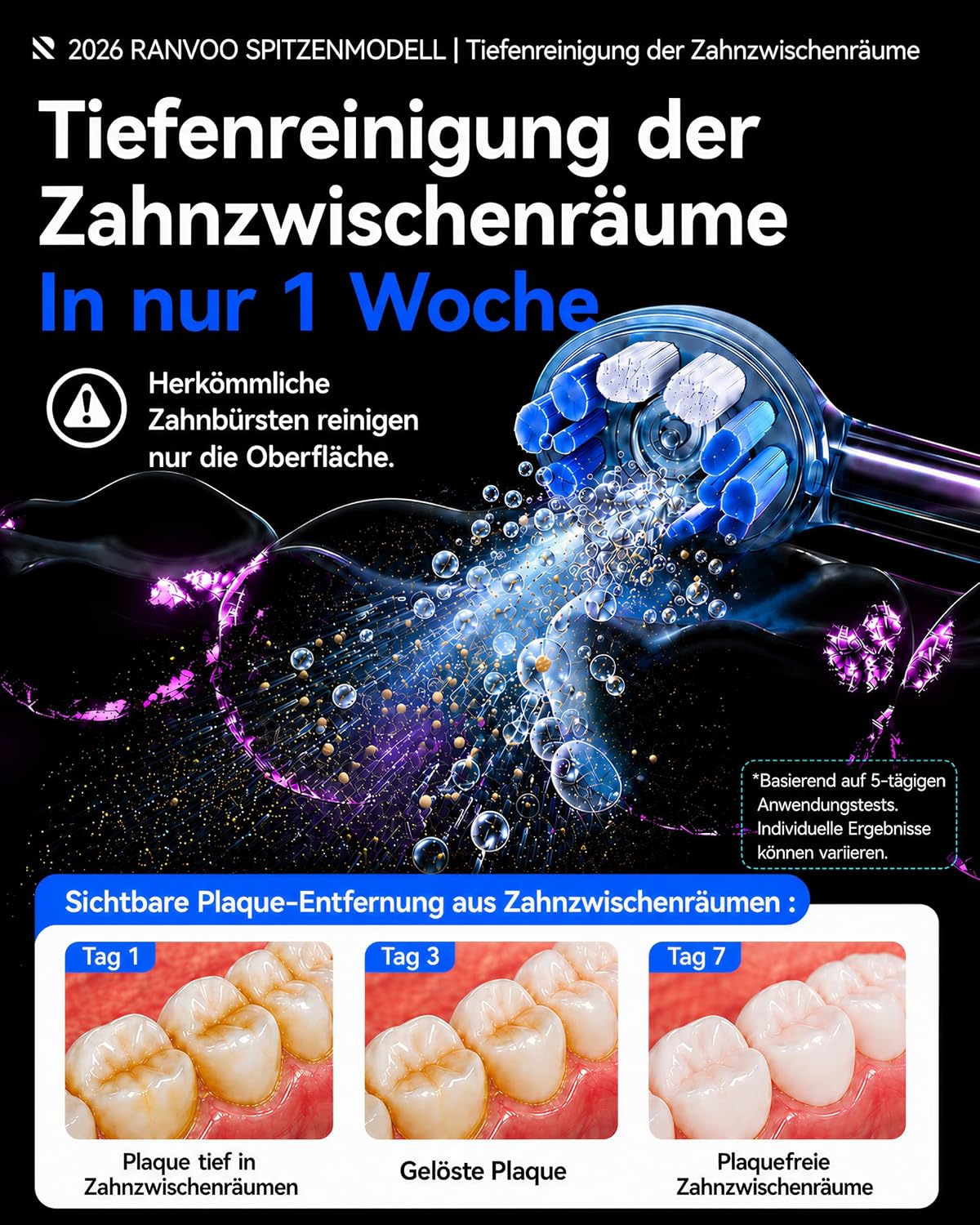 AirJet X5 Elektrische Zahnbürste, Tiefenreinigung, Stahlblau | 100% Plaque-Entfernung, 7-Tage-Aufhellung, Zahnfleischpflege, für Zahnspangen, 60 Tage Akku, 3 Köpfe, zahnärztlich empfohlen – Bild 8
