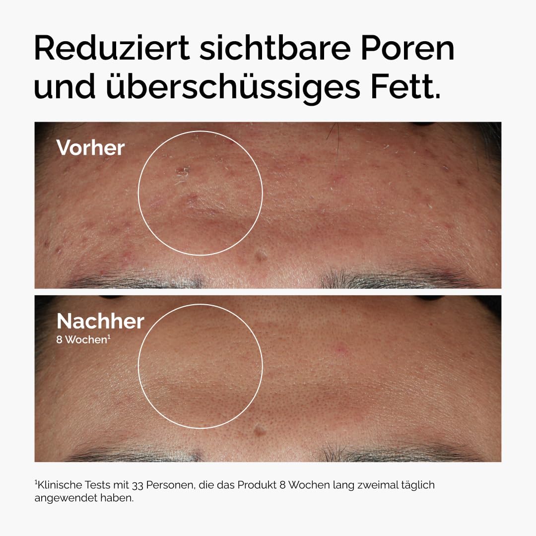 THE ORDINARY Niacinamid 10% + Zink 1%, 30ml – Bild 2