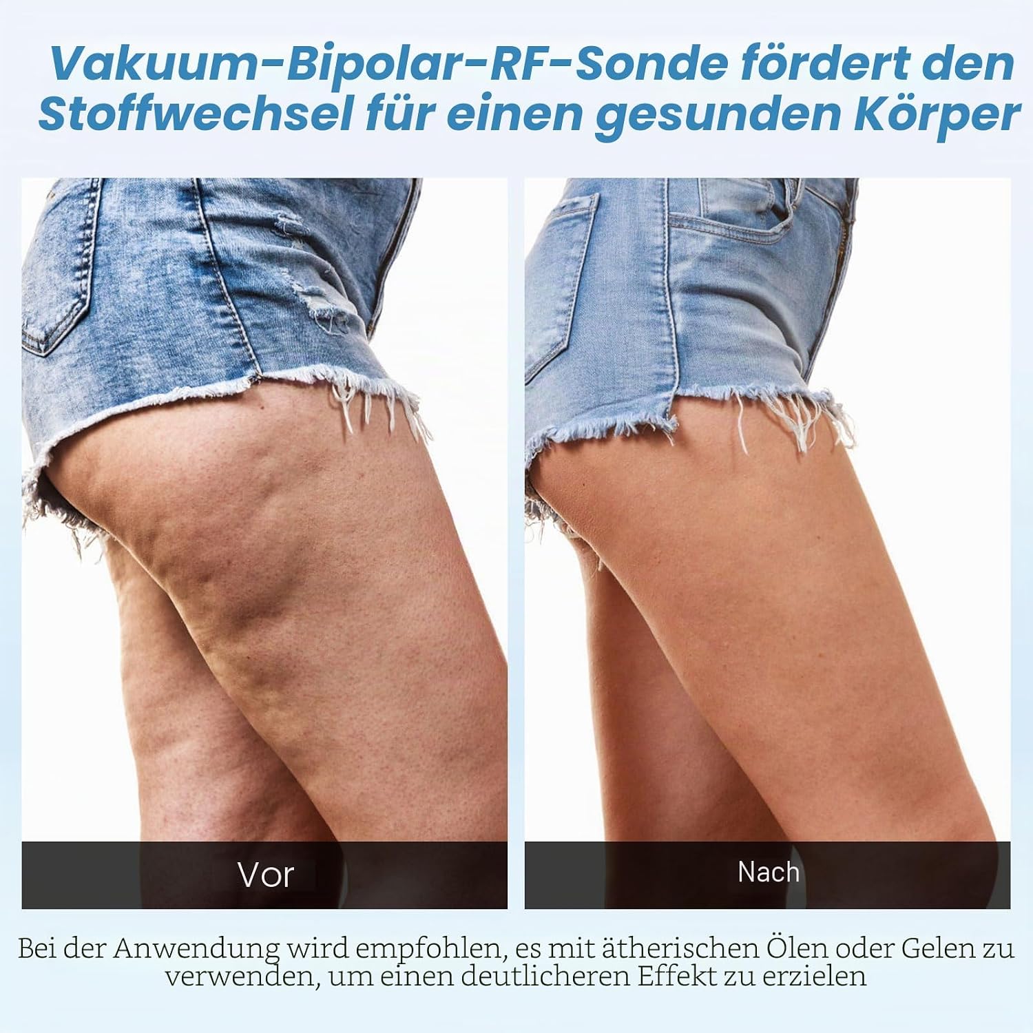 Cellulite Massagegerät 4 in 1 40K Kavitation & Radiofrequenz & Vakuum Gerät – Bild 5